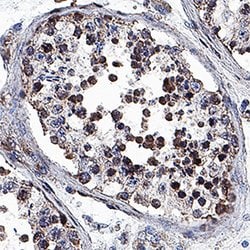 Human VRK1 Antibody, R D Systems 25&mu;g; Unlabeled:Antibodies, Monoclonal