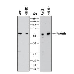 Human/Mouse/Rat Vimentin Antibody, R D Systems 25 &mu;g | Buy Online | R&D Systems | Fisher Scientific