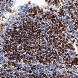 Human ZNF10 Antibody, R D Systems:Antibodies:Primary Antibodies