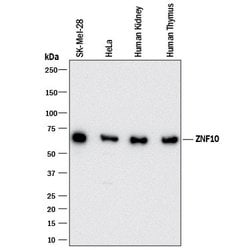 Human ZNF10 Antibody, R D Systems:Antibodies:Primary Antibodies