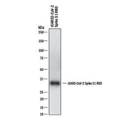 SARS-CoV-2 Spike S1 Subunit Antibody, R D Systems:Antibodies:Primary Antibodies
