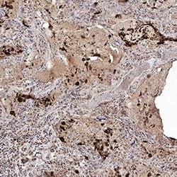 SARS-CoV-2 Spike S2 Subunit Antibody, R D Systems 100 &mu;g; Unconjugated:Antibodies