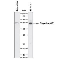 Human/Rat alpha-Fetoprotein/AFP Antibody, R D Systems 25&mu;g; Unlabeled:Antibodies,