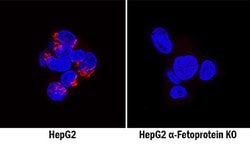 Human alpha-Fetoprotein/AFP Antibody, R D Systems 25&mu;g; Unlabeled:Antibodies,