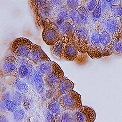 Human alpha-Methylacyl-CoA Racemase/AMACR Antibody, R D Systems 25&mu;g;