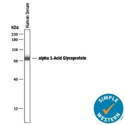 Human alpha 1-Acid Glycoprotein Antibody, R D Systems 25&mu;g; Unlabeled:Antibodies,