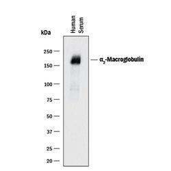 Human alpha 2-Macroglobulin Antibody, R D Systems 25&mu;g; Unlabeled:Antibodies,