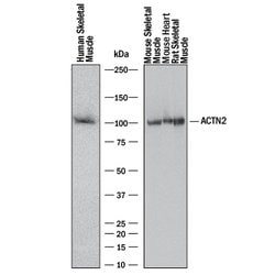 Human/Mouse/Rat alpha Actinin 2 Antibody, R D Systems 25&mu;g:Antibodies,