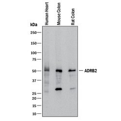 Human/Mouse/Rat beta-2 Adrenergic R/ADRB2 Antibody, R D Systems:Antibodies:Primary
