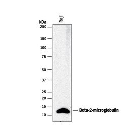 Human beta 2-Microglobulin Antibody, R D Systems:Antibodies:Primary Antibodies