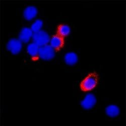 Human Siglec-2/CD22 LlaMABodyTM Bivalent VHH HuIgG2 Fusion Antibody, R