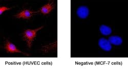 Human ST2/IL-33R LlaMABodyTM Bivalent VHH HuIgG2 Fusion Antibody, R D Systems