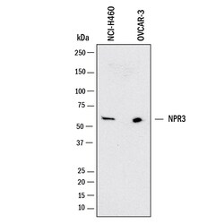 Human NPRC/NPR3 Antibody, R D Systems:Antibodies:Primary Antibodies