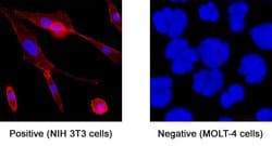 Mouse B7-H3 Antibody, R D Systems:Antibodies:Primary Antibodies