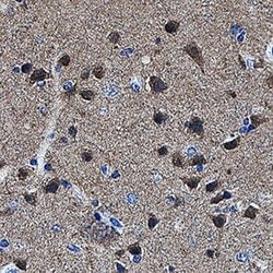 Human GPR158 Antibody, R D Systems 25 &mu;g; Unconjugated:Antibodies, Monoclonal