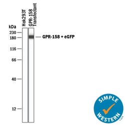 Human GPR158 Antibody, R D Systems 25 &mu;g; Unconjugated:Antibodies, Monoclonal