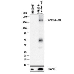 Human GPR158 Antibody, R D Systems 25 &mu;g; Unconjugated:Antibodies, Monoclonal