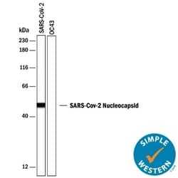 SARS-CoV-2 Nucleocapsid Antibody, R D Systems 100 &mu;g; Unconjugated:Antikörper