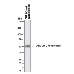 SARS-CoV-2 Nucleocapsid Antibody, R D Systems 100 &mu;g; Unconjugated:Antikörper