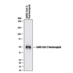 SARS-CoV-2 Nucleocapsid Antibody, R D Systems 25 &mu;g; Unconjugated:Antibodies,
