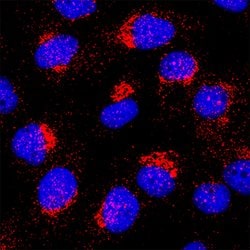 Human GM2/GD2 Synthase/ B4GALNT1 Antibody, R D Systems 100 &mu;g | Buy Online | R&D Systems | Fisher Scientific