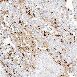 SARS-CoV-2 Spike S1 Subunit Antibody, R D Systems 100 &mu;g; Unconjugated:Antibodies,