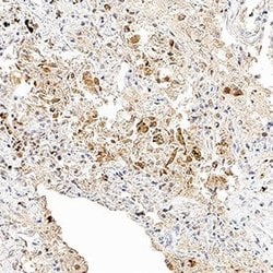 SARS-CoV-2 Spike RBD Antibody, R D Systems:Antibodies:Primary Antibodies