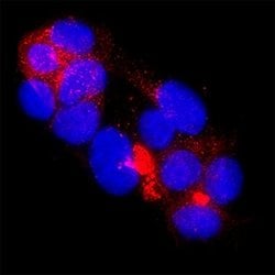 Human CA19-9 Antibody, R D Systems:Antibodies:Primary Antibodies