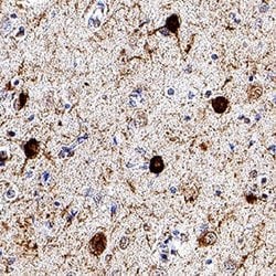 Human Tau Antibody, R D Systems:Antibodies:Primary Antibodies