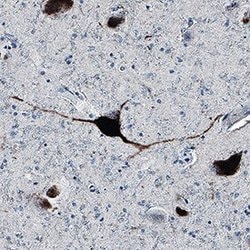 Human Tau Antibody, R D Systems:Antibodies:Primary Antibodies