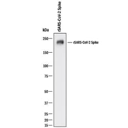 SARS-CoV-2 Spike S2 Subunit Antibody, R D Systems 100 &mu;g; Unconjugated:Anticuerpos