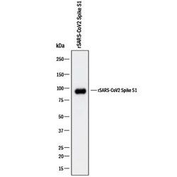 SARS-CoV-2 Spike S1 Subunit Antibody, R D Systems 25 &mu;g; Unconjugated:Antibodies,