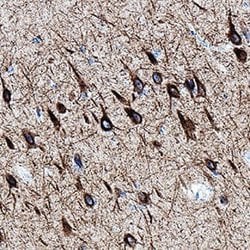 Human NF-L Antibody, R D Systems 25 &mu;g; Unconjugated:Antibodies, Monoclonal