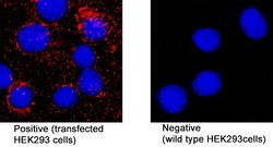 SARS-CoV-2 Membrane Antibody, R D Systems:Anticuerpos:Anticuerpos primarios