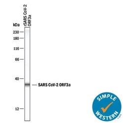 SARS-CoV-2 ORF3a Antibody, R D Systems 25 &mu;g; Unconjugated:Antibodies,