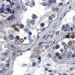 Human SF-1/NR5A1 Antibody, R D Systems:Antibodies:Primary Antibodies