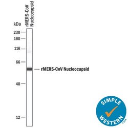 MERS-CoV Nucleocapsid Antibody, R D Systems 25 &mu;g; Unconjugated:Antibodies,