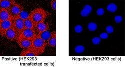 Human GHRHR Antibody, R D Systems 25 &mu;g; Unconjugated:Antibodies, Monoclonal