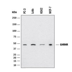 Human GHRHR Antibody, R D Systems 25 &mu;g | Buy Online | R&D Systems | Fisher Scientific