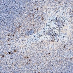 Human BCMA/TNFRSF17 Antibody, R D Systems:Antibodies:Primary Antibodies