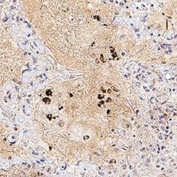 SARS-CoV-2 ORF8 Antibody, R D Systems 25 &mu;g; Unconjugated:Antibodies,