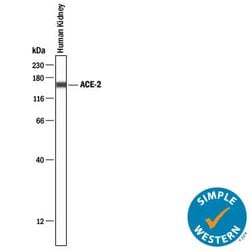 Human ACE-2 Antibody, R D Systems 100 &mu;g; Unconjugated:Antibodies, Monoclonal