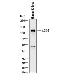 Human ACE-2 Antibody, R D Systems 100 &mu;g; Unconjugated:Antibodies, Monoclonal