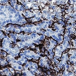 Human ACE-2 Antibody, R D Systems 25 &mu;g; Unconjugated:Antibodies, Monoclonal
