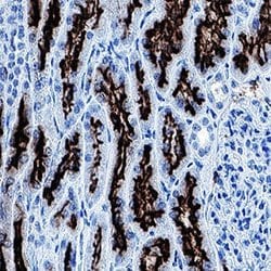 Human ACE-2 Antibody, R D Systems 100 &mu;g; Unconjugated:Antibodies, Monoclonal