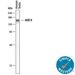 Human ACE-2 Antibody, R D Systems 100 &mu;g; Unconjugated:Antibodies, Monoclonal