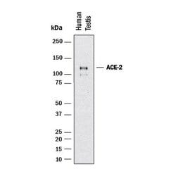 Human ACE-2 Antibody, R D Systems 100 &mu;g; Unconjugated:Antibodies, Monoclonal