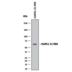 SARS-CoV-2 Spike RBD Antibody, R D Systems 100 &mu;g; Unconjugated:Antibodies,