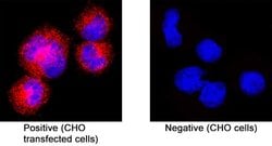 SARS-CoV-2 Spike RBD Antibody, R D Systems 100 &mu;g; Unconjugated:Antibodies,