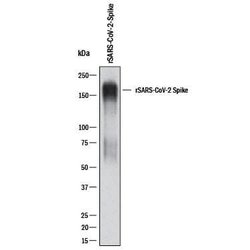 SARS-CoV-2 Spike S2 Subunit Antibody, R D Systems:Antibodies:Primary Antibodies